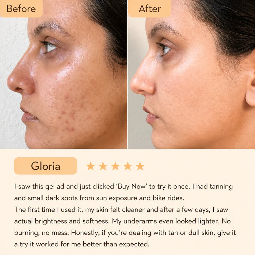 Anua Niacinamide 10% + TXA 4% for Brightening and Dark Spots