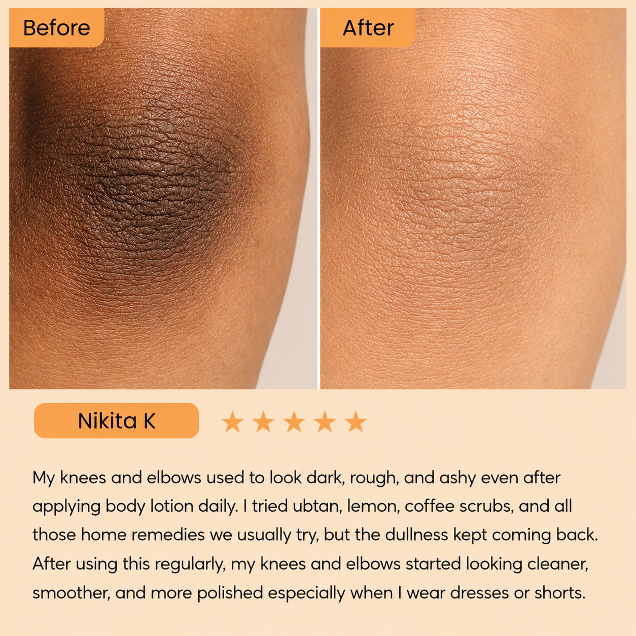 Dr. Melaxin Peel Shot: Brightening Body Spray
