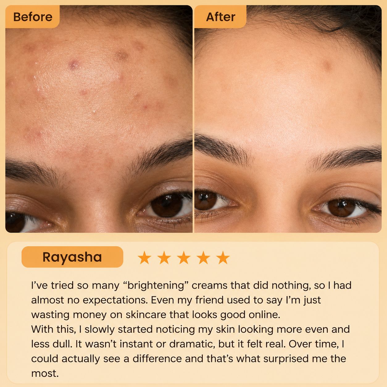 Celimax Pore + Dark Spot Brightening Cream