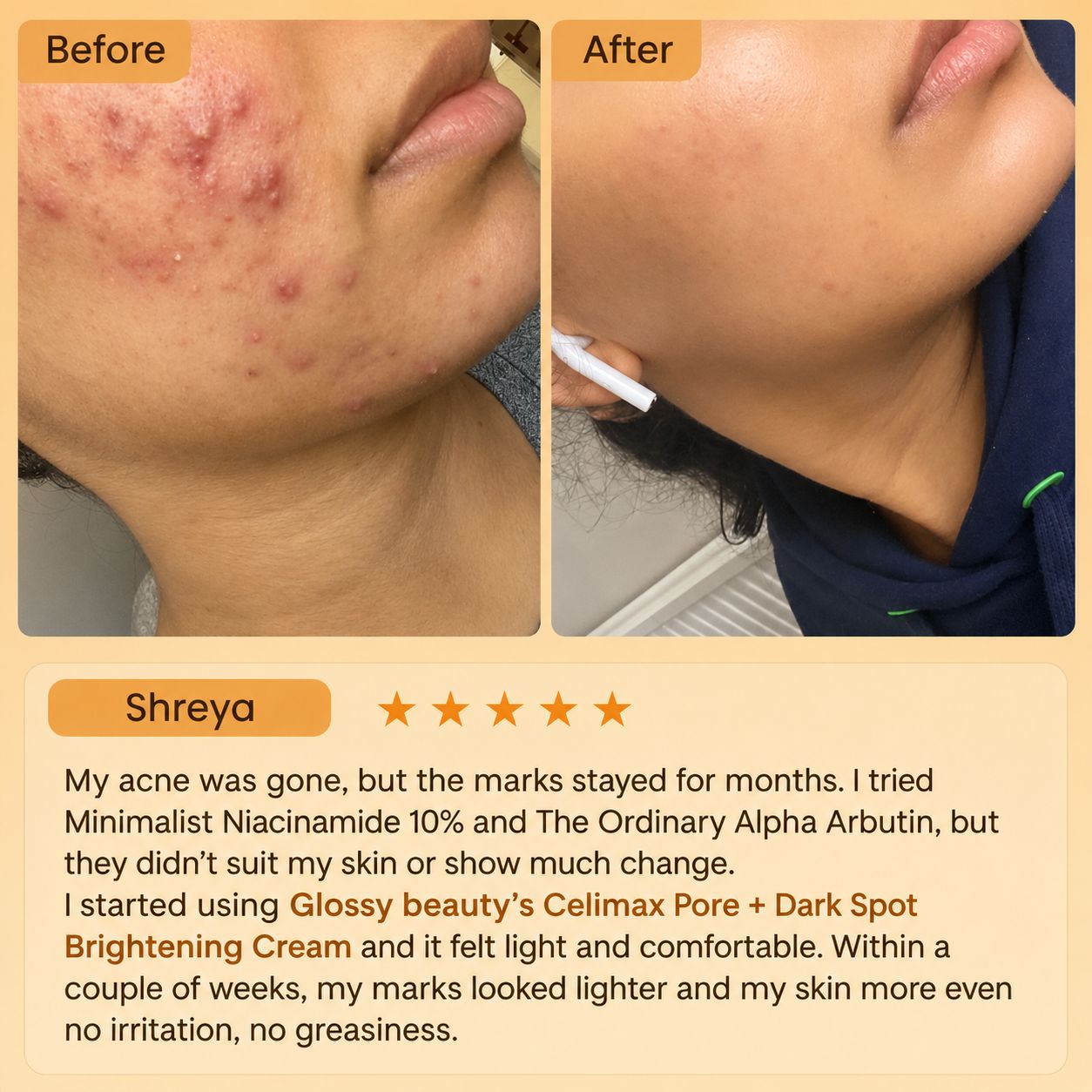 Celimax Pore + Dark Spot Brightening Cream