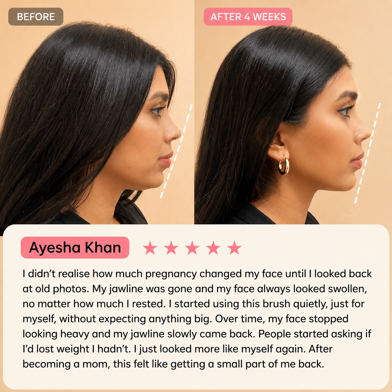 Lymphatic Brush – Your 5-Minute Face Fix