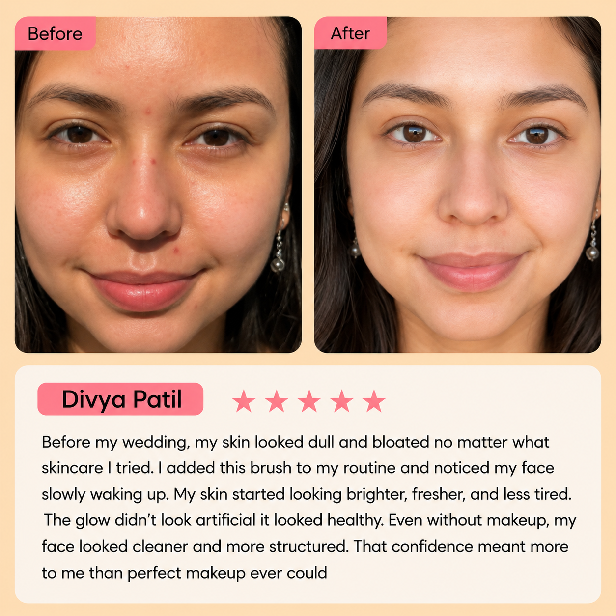 Lymphatic Brush – Your 5-Minute Face Fix