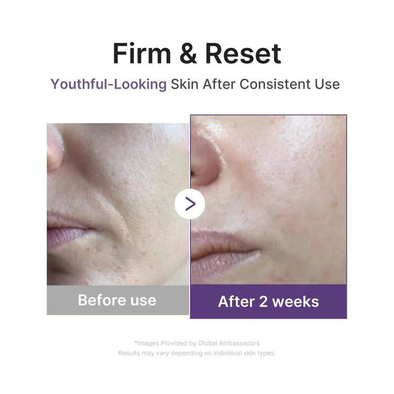 Medicube Retinol NMN Boosting Serum